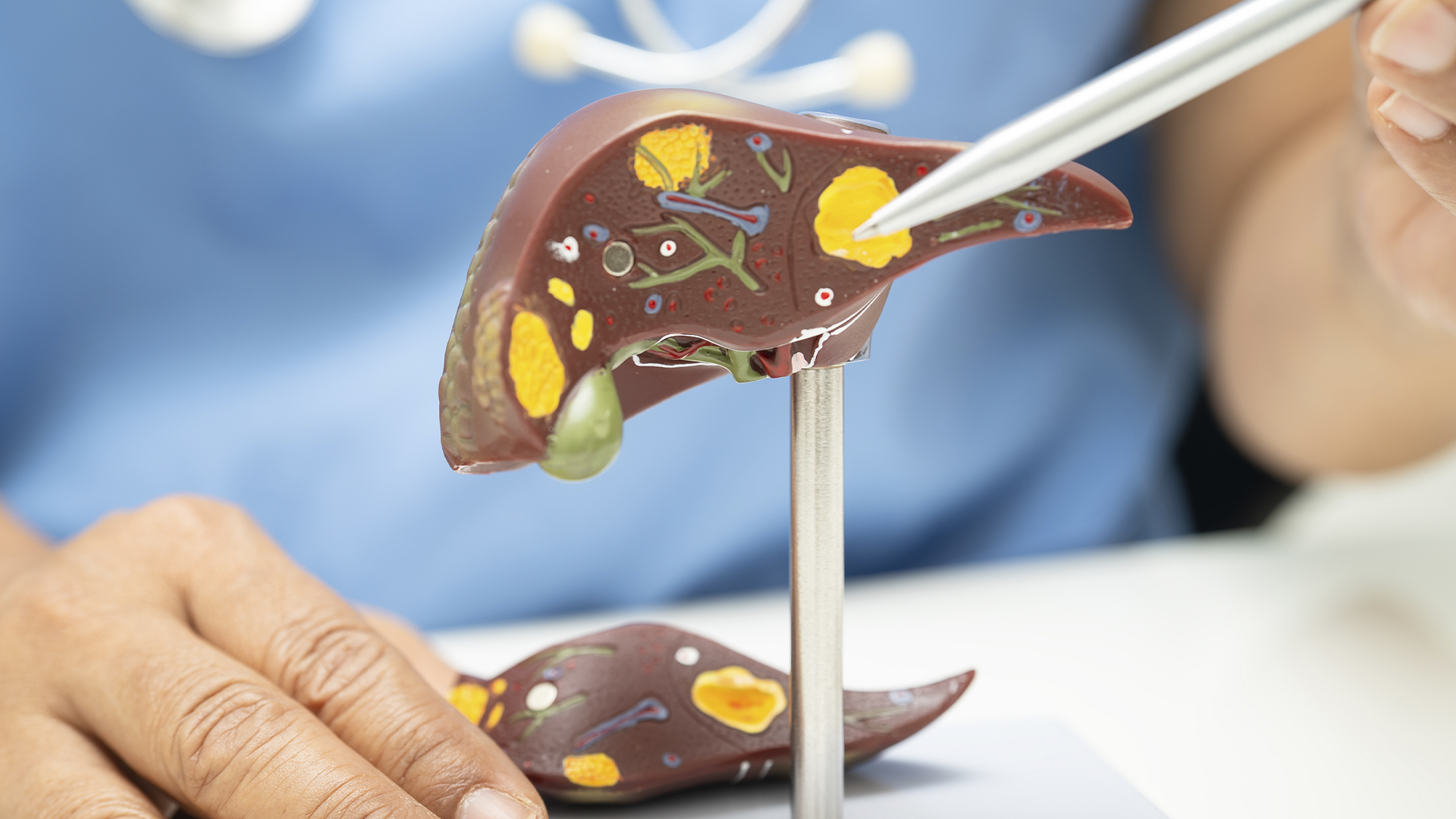 O Eixo Hepato-Metabólico: A Evidência Clínica por Trás do Suporte com HEPRO