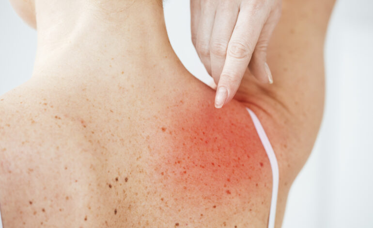 Magnésio e cúrcuma: abordagem nutricional para modulação inflamatória e suporte ao equilíbrio metabólico